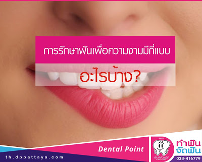 รักษาฟันเพื่อความงาม