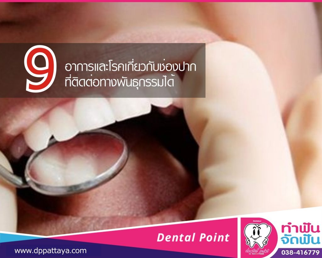 อาการและโรคในช่องปาก