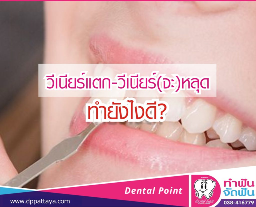วีเนียร์แตก วีเนียร์(จะ)หลุด ทำยังไงดี?