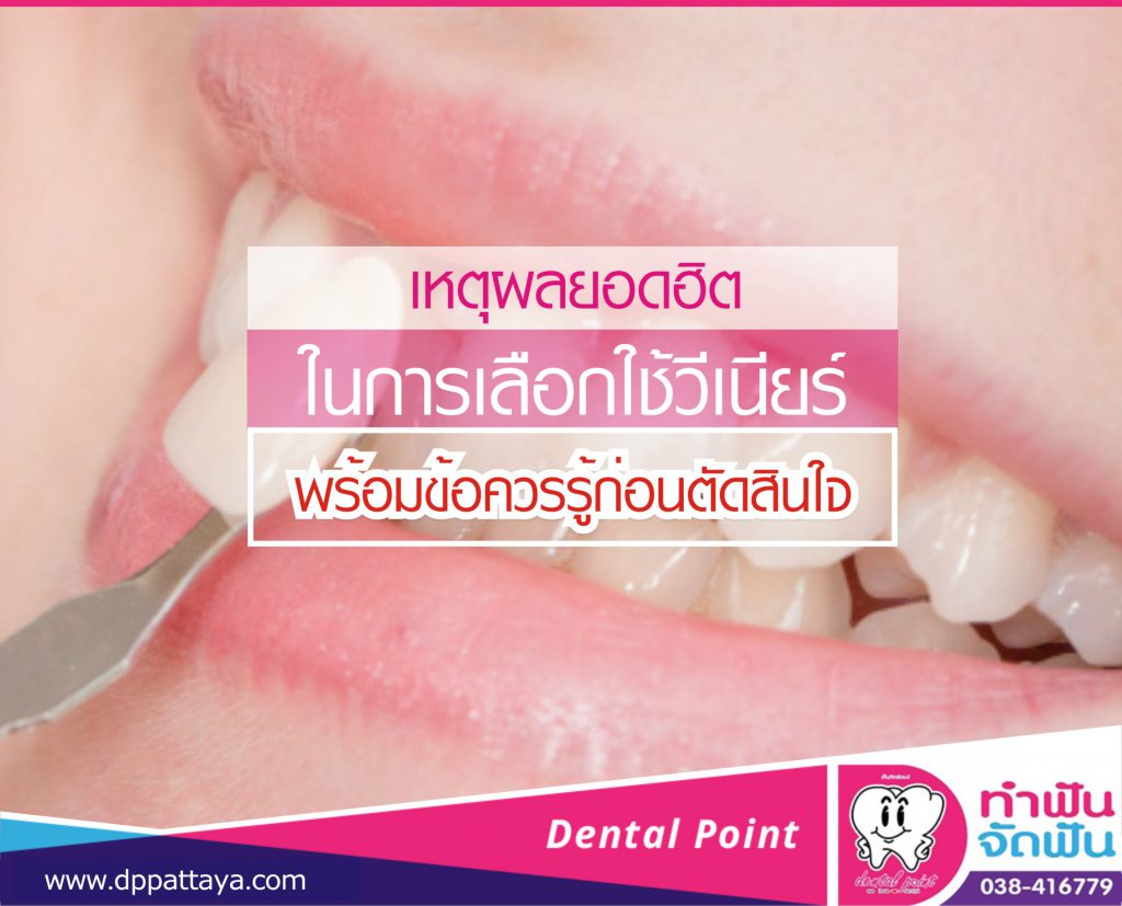 เหตุผลยอดฮิตว่าทำไมต้องทำ วีเนียร์