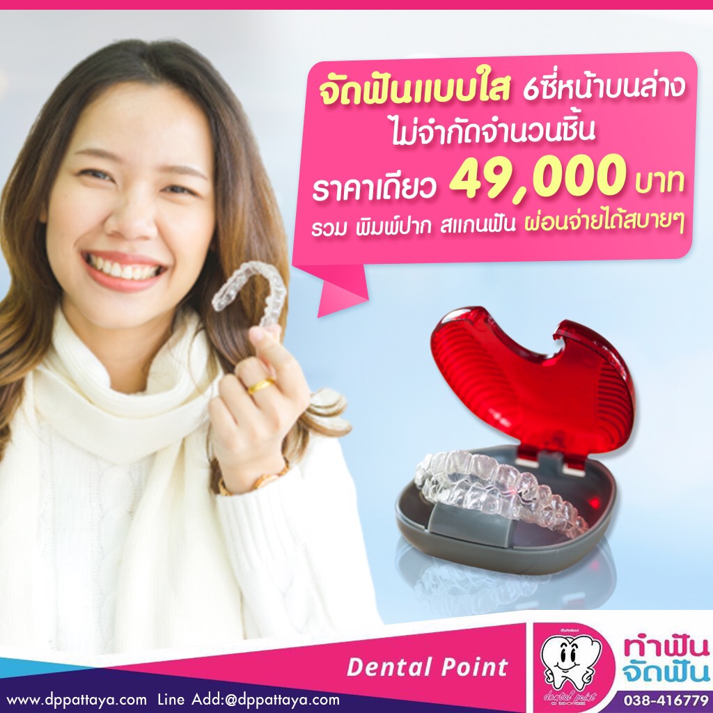 โปรโมชั่นจัดฟันใส จัดฟันแบบใส ราคาเดียว 49000