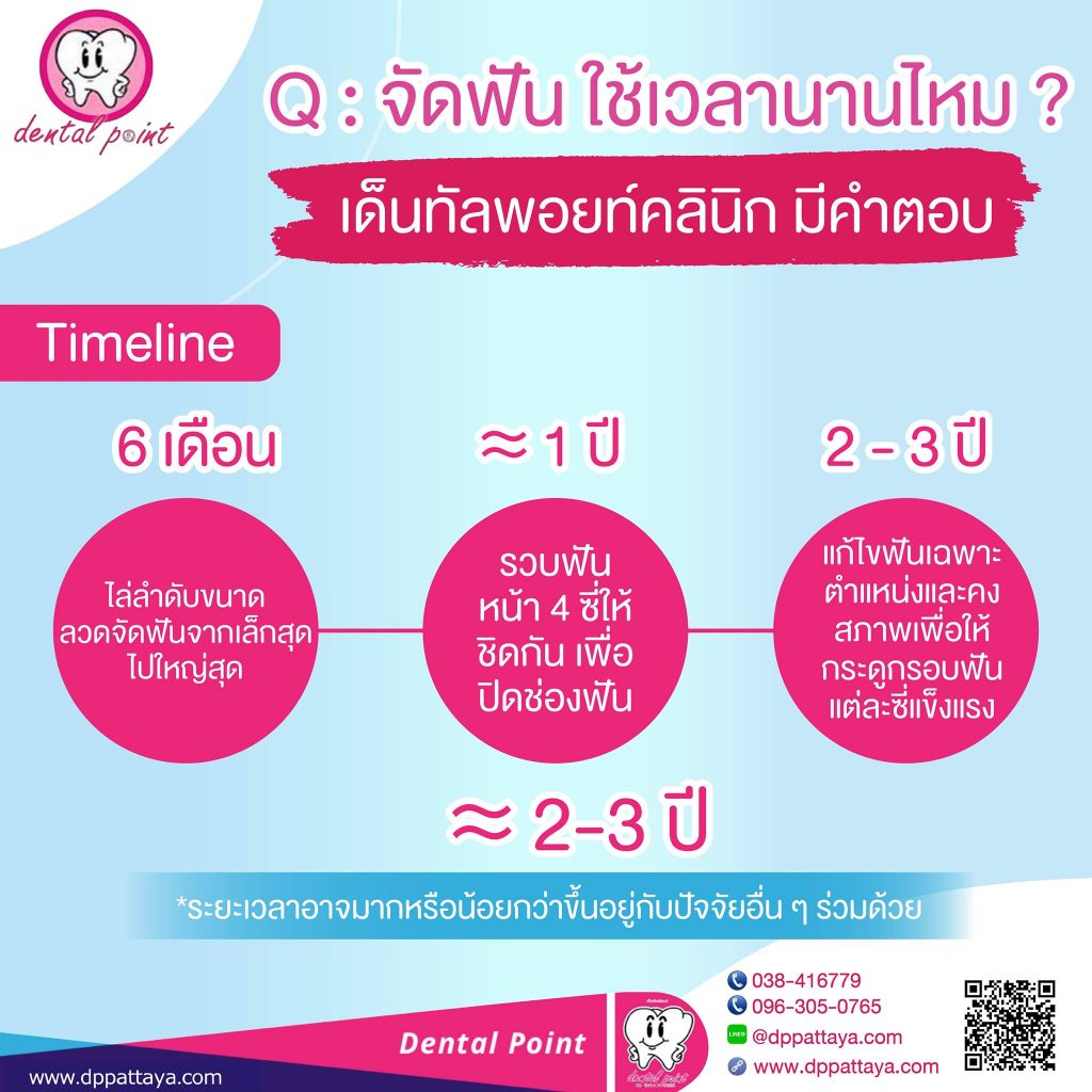 จัดฟันใช้เวลานานไหม