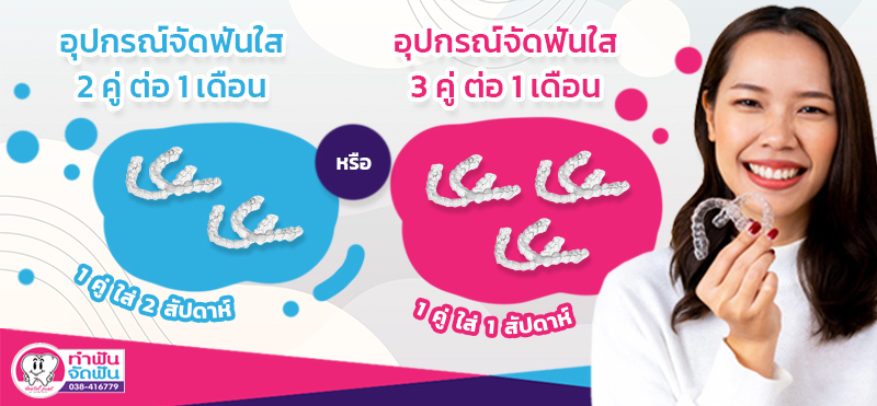 โปรจัดฟันแบบใส จัดฟันใส