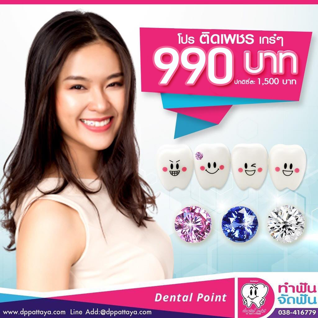 เมนูฟันติดเพชร โปรโมชั่นฟันติดเพชร