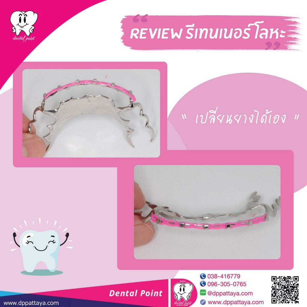 รีเทนเนอร์เปลี่ยนยาง