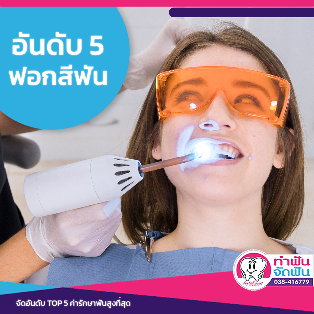 อันดับ 5 ฟอกสีฟัน ค่ารักษาฟัน