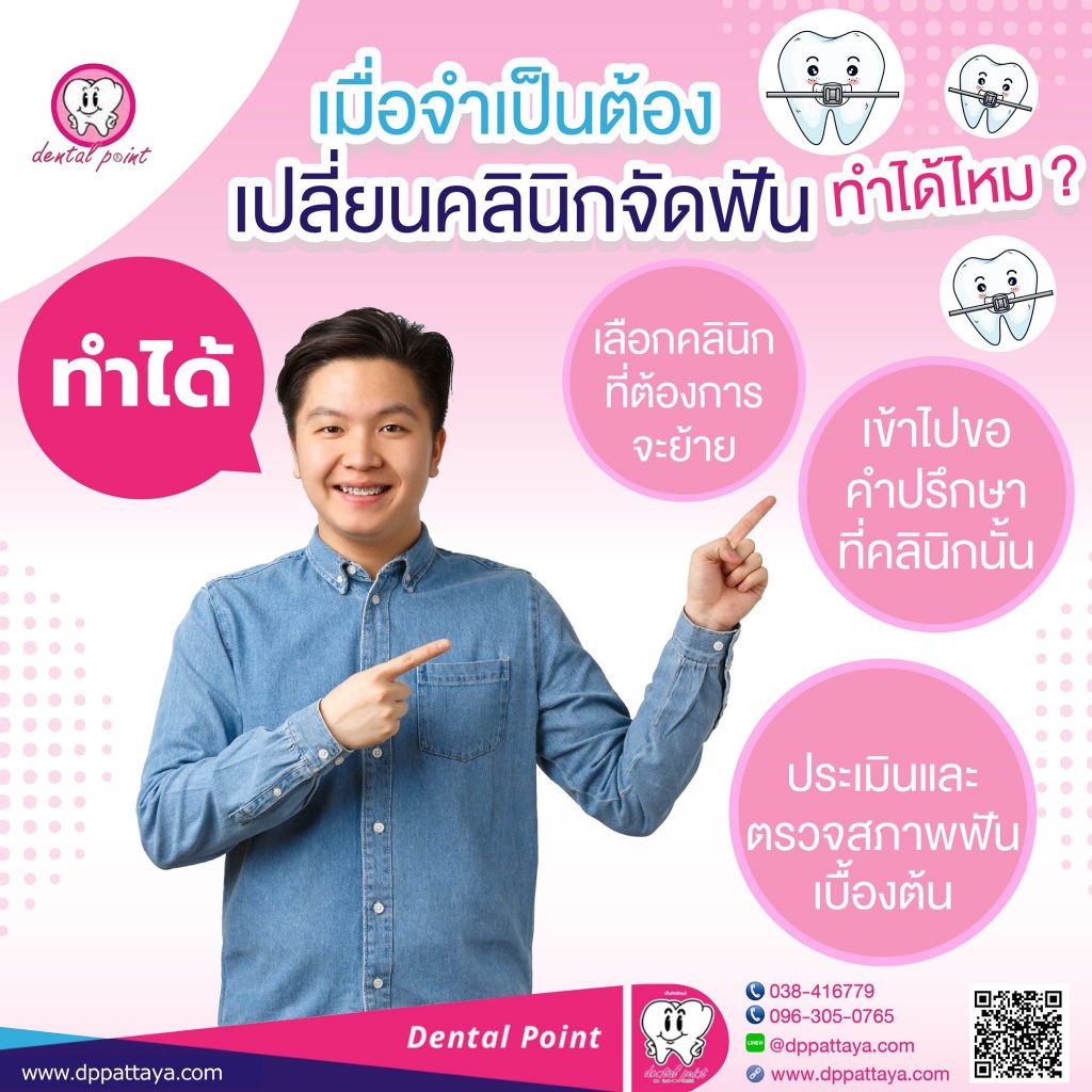 ย้ายเคสจัดฟัน ทำได้ไหม