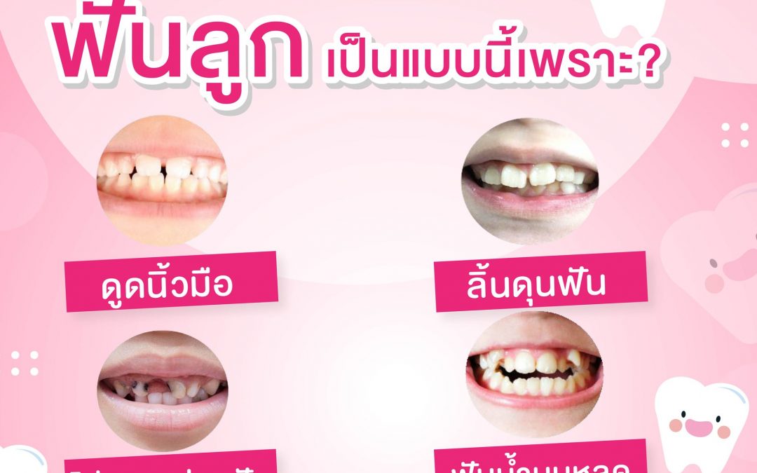 สงสัยไหม ฟันลูกเป็นแบบนี้ เพราะอะไร ?